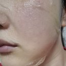 주식회사 웰더스 스마트 케어 | 힐로인 보툴리늄 톡신 마스크팩 후기 – HEALOINE botulinum mask로 피부톤 개선 &amp; 탄력 케어