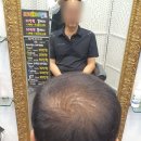 김호증모가발by헤어리서치 이미지