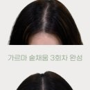 로기SMP 이미지