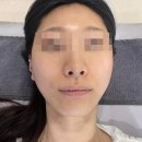 천년의미;영평나인 | 선릉역피부관리, <뷰티크나인 스킨앤왁싱> 블랙헤드 케어 후기