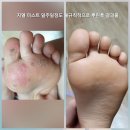 지엘XIEL