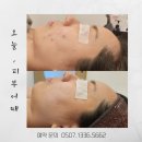 오늘, 피부어때