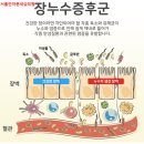 세원의원 | 자율신경치료 후기｜장루수 증후군으로 인한 미열·인후통·전신통증이 사라진 이유