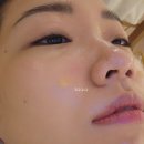 가양역피부관리 가양에스테틱 [ 뷰티힐 ] 스킨디톡스 관리