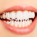 최신심미치과기공소 | 강남 라미네이트 가격 차이, 3분이면 이해되는 정리 가이드