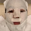 전주 효자동 피부관리 미안당에스테틱 열 케어 후기