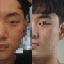[왕십리 눈썹문신] [남자 눈썹문신] 유빌라테 후기~~ 내 눈썹은 아니고 친구인 남자눈썹 문신^^ 할인...