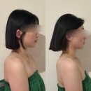 신안아파트 앞 상가 | [ 김포 풍무동 얼굴 윤곽 관리 라파에스떼 l 얼굴 비대칭 개선 JH윤곽술 생생한 후기 ]