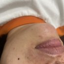꼼꼼이 왁싱 | 일산 왁싱 주엽동 미모부심 인중왁싱 후기