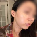 리베리의원 | 영종도 피부과 리베리의원 , 내돈내산 회원권 후기 !