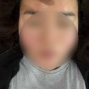 아름다운의원 | [뷰티정보]건대 피부과/아름다운의원 건대점/건대 인모드 후기/건대 피부과 인모드/건대입구피부과/광진...
