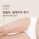 압구정바로미치과의원 | 압구정여성의원 질필러, 질레이저 후기 당일 바로 효과 가능?!