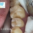 동의치과기공소 이미지