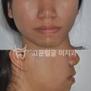 고운얼굴이치과교정과치과의원 | 청주 치아교정치과 여러 번 고민한 이유를 들어보면...