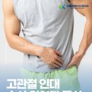 서울오케이신경외과의원 | 고관절 인대 손상 원인과 증상, 일상에서 주의할 점
