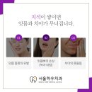 서울하우치과 이미지