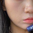 강남우태하피부과의원 | 강남피부과 필로드 쁨의원 효과 내돈내산 후기