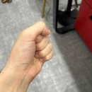 허리통증 디스크 요통 치료방법 [창원 도수치료]