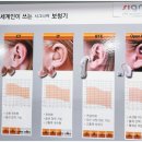 독일디지탈보청기 이미지