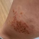 관악우태하피부과의원 이미지