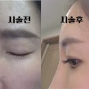 미성프라자빌딩 | 시흥 배곧 속눈썹연장 9mm→10mm 바꾸고 인생 눈매 찾다