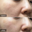 킨아이스토어 | 올인원 토탈 안티에이징 크림 추천: 킨뮬러 센시티브 리스토어크림 후기