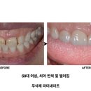 대가치과기공소 네이버블로그
