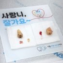 서울에이치(H)치과교정과치과의원 | 분당 사랑니 발치, 야탑 서울사랑니안녕치과 추천 후기 (feat.1개월 경과)
