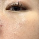 선한약국 | PDRN 선크림 셀베인 피디알엔 데일리 선크림으로 피부회복