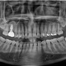 이도치과기공소 이미지