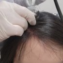 홀드의원 이미지