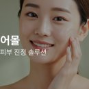 김정문알로에2