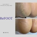 리풋(ReFOOT)