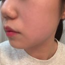 스킨춘천점]아몬드필 화이트태닝후기 브라이트닝 매끈피부 깔끔한관리실 편안한분위기 전문적손길 모델링팩