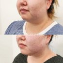 투턱 이미지