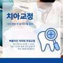 은행동치아교정 비발치교정과 교합 안정성을 위한 관리
