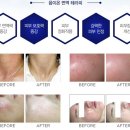 피움스킨케어