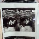 봄빛병원 | 봄빛병원 정밀초음파 후기