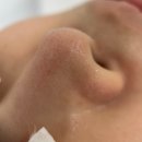 [뷰티] 결뷰티 / 안산피부관리, 아쿠아필 잘하는 곳, 여드름관리, 아쿠아필, 피부컨설팅