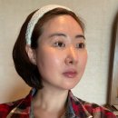 케이메디칼(주) | 대구반월당피부과 올리지오 600샷 리프팅 내돈내산 후기(1주일 경과, 붉은기)