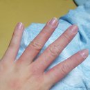 미소가인피부과의원 | [내돈내산]미소가인 피부과 일산점 후기/일산 피부과 전문의 병원/피부질환보는 병원/미소가인피부과 주차