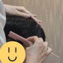 아미치 | 대전두피관리 아미치0.3 대전점 두피검사 후기