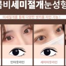 팝성형외과의원 이미지