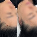결헤어 네이버블로그