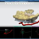 림플란트치과의원 이미지
