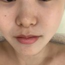랑스스킨 | 캡슐로 피부결 쫀쫀하게! 명지피부관리 랑스에스테틱에서 인생 피부 찾기