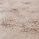 운정프라자약국 | 파주운정내과 탈모약, 복용 중 효과는 어떻게 확인해야 할까요?