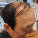 딸의 사랑~ 부모님의 젊음을 되찾아드린 최고의 선물. 인생 첫 가발 선물은 사하구 모이든 뉴헤어에서