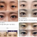 쉬즈라인의원 | 부산 북구 성형외과 잘하는 곳, 유명한 곳, 리뷰 인기순위 TOP 5