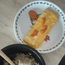 서울연세안과 라섹 솔직한 후기